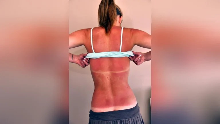 Öko-Test hat 26 Sonnencremes mit SPF 50 untersucht. Nur drei Produkte erhielten die Note „Sehr gut“, während 11 den angegebenen UV-Schutz nicht erreichten.