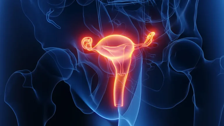 Endometriose mit erhöhtem Risiko für Typ-2-Diabetes in Verbindung gebracht Große Studie zeigt: Bei Endometriose könnte das Risiko für Typ-2-Diabetes um 46 Prozent steigen, bei manchen Formen sogar auf mehr als das Doppelte.